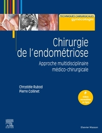 Picture of Chirurgie de l'endométriose