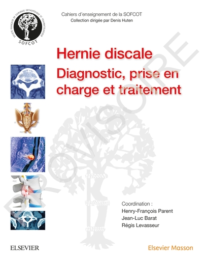 Image de La hernie discale lombaire