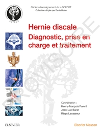 Image de La hernie discale lombaire