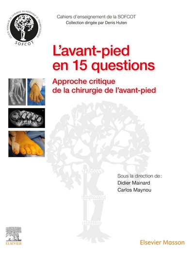 Picture of L'avant-pied en 15 questions