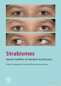 Picture of Strabisme