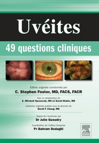 Image de Uvéites : 49 questions cliniques