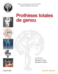 Image de Prothèses totales de genou