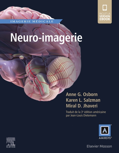 Picture of Neuro-imagerie