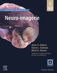 Picture of Neuro-imagerie
