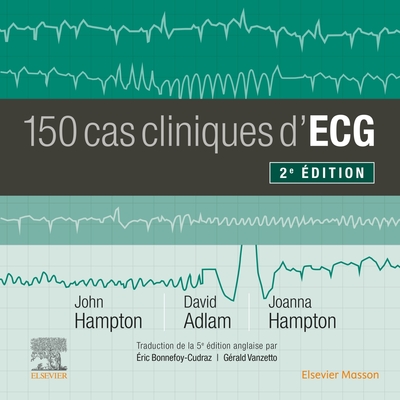 Image de 150 cas cliniques d'ECG