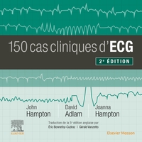 Image de 150 cas cliniques d'ECG