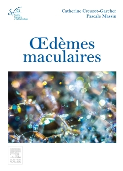 Picture of Oedèmes maculaires