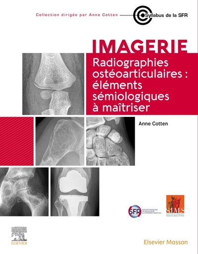 Picture of Radiographies ostéoarticulaires : éléments sémiologiques à maitriser