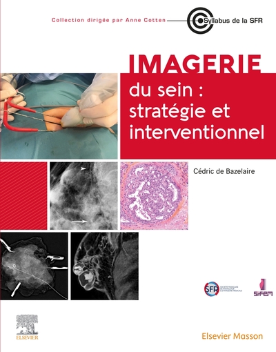 Image de Imagerie du sein : stratégie et interventionnel