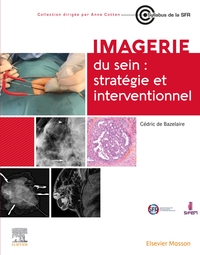 Image de Imagerie du sein : stratégie et interventionnel