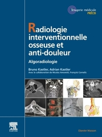 Picture of Radiologie Interventionnelle osseuse et anti-douleur