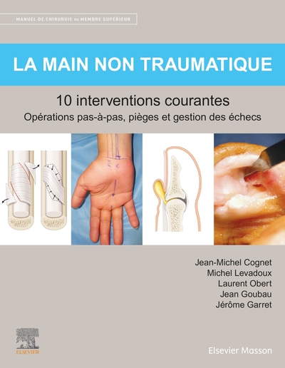 Picture of La main non traumatique 10 interventions courantes