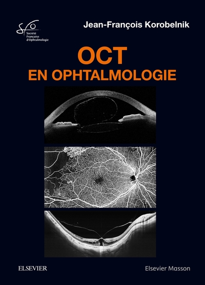 Image de OCT en ophtalmologie