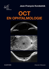 Image de OCT en ophtalmologie
