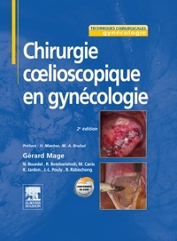 Picture of Chirurgie coelioscopique en gynécologie