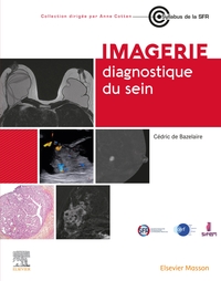 Image de Imagerie diagnostique du sein