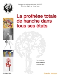 Picture of La prothèse totale de hanche dans tous ses états
