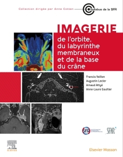 Picture of Imagerie de l'orbite, du labyrinthe membraneux et de la base du crâne