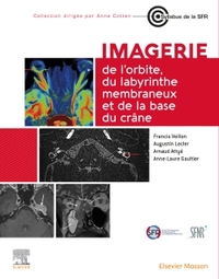 Picture of Imagerie de l'orbite, du labyrinthe membraneux et de la base du crâne