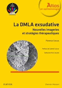 Picture of La DMLA exsudative