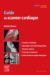 Image de Guide de scanner cardiaque