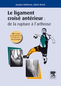 Picture of LIGAMENT CROISE ANTERIEUR