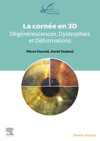 Picture of La Cornée en 3D : dégénérescences, dystrophies et déformations cornéennes