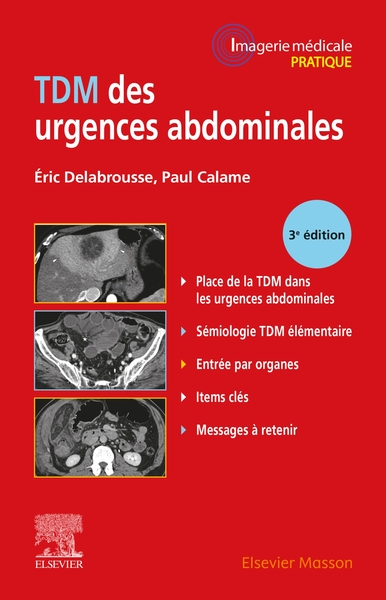 Image de TDM des urgences abdominales