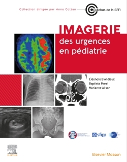 Picture of Imagerie des urgences en pédiatrie