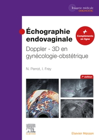 Picture of Échographie endovaginale Doppler - 3D