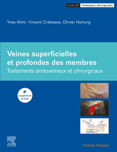 Picture of Veines superficielles et profondes des membres