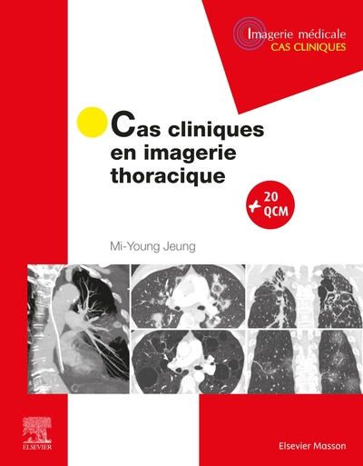 Picture of Cas cliniques en imagerie thoracique