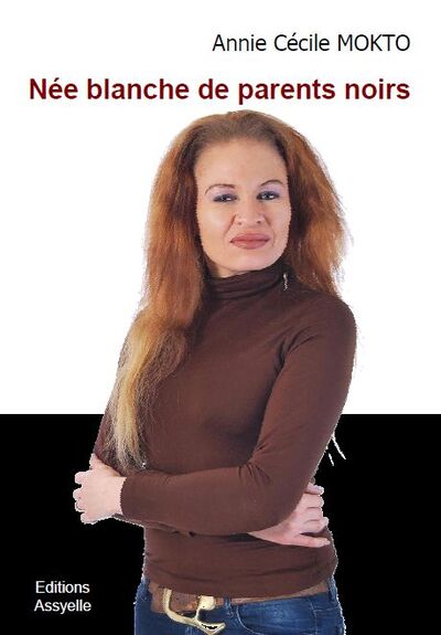 Image de Née blanche de parents noirs