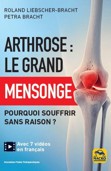 Picture of Arthrose : le grand mensonge