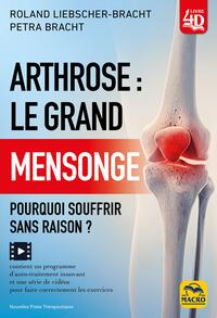 Image de Arthrose : le grand mensonge