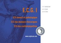 Picture of ECG I : ECG normal et pathologique, ECG des douleurs thoraciques, ECG des cardiomyopathies