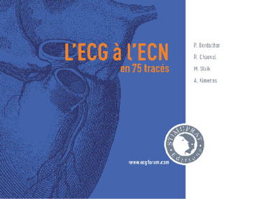 Picture of L'ECG à L'ECN en 75 tracés