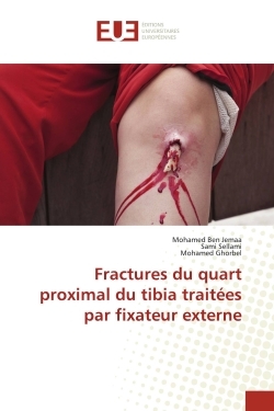 Picture of Fractures du quart proximal du tibia traitées par fixateur externe