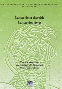 Image de CANCER DE LA THYROIDE - CANCER DES LEVRES