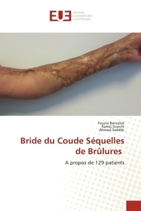Picture of Bride du Coude Séquelles de Brûlures