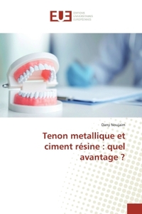 Picture of Tenon metallique et ciment résine : quel avantage ?