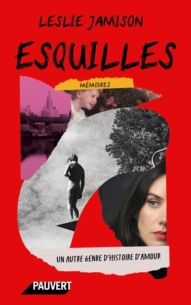 Picture of Esquilles
