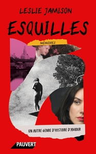 Picture of Esquilles