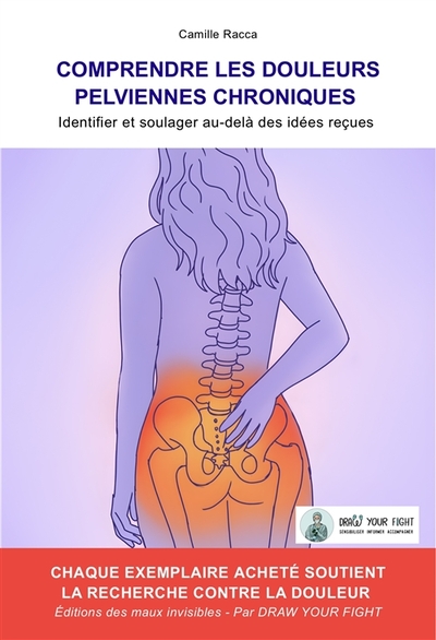 Image de Comprendre les douleurs pelviennes chroniques