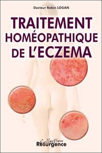 Image de Traitement homéopathique de l'eczéma
