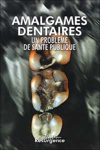 Image de Amalgames dentaires