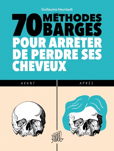 Image de 70 METHODES BARGES POUR ARRETER DE PERDRE SES CHEVEUX