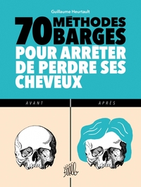 Image de 70 METHODES BARGES POUR ARRETER DE PERDRE SES CHEVEUX