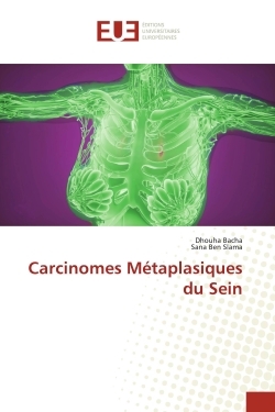 Picture of Carcinomes Métaplasiques du Sein